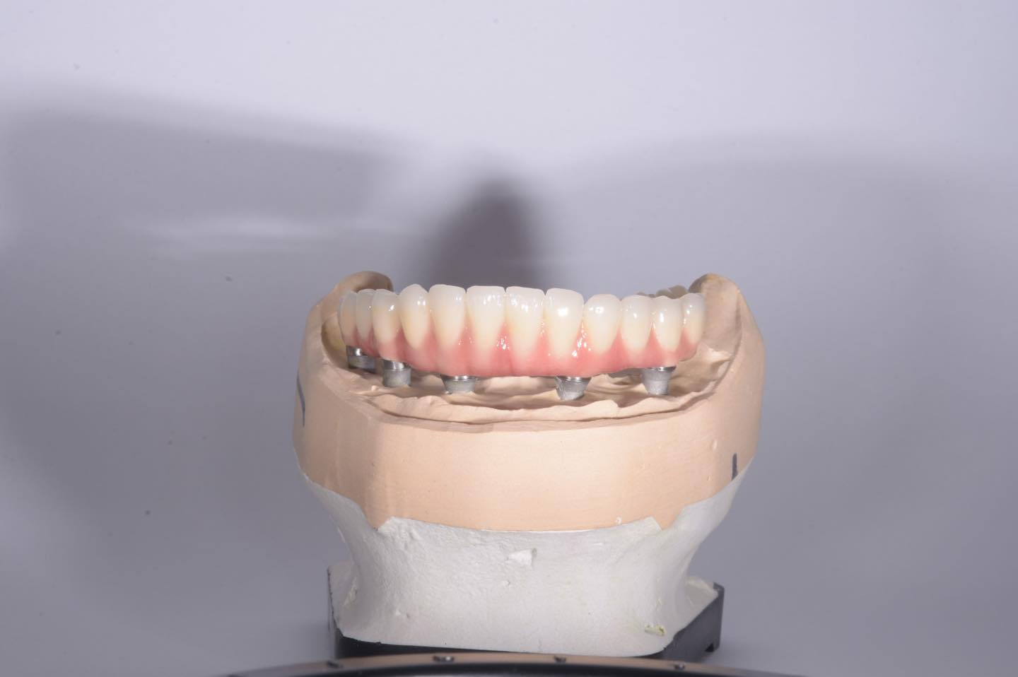implant dentar all on 6
