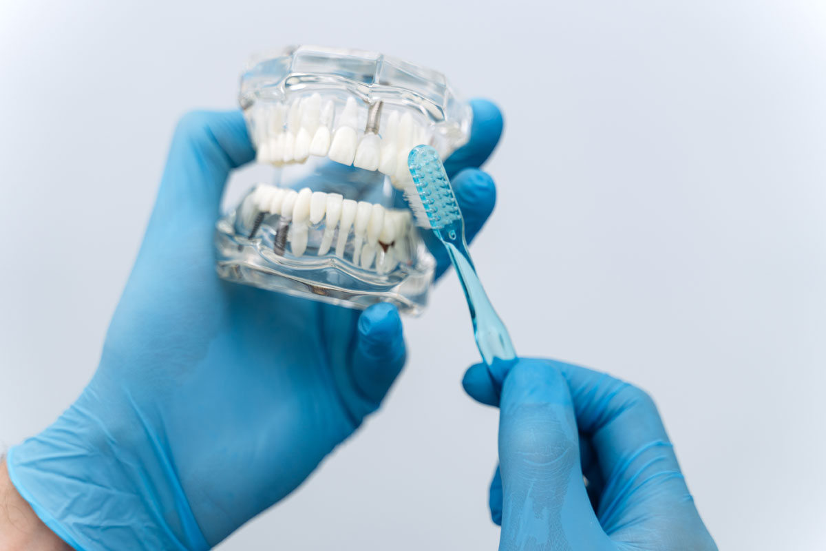 indicatii complete pentru igiena orala dupa implantul dentar