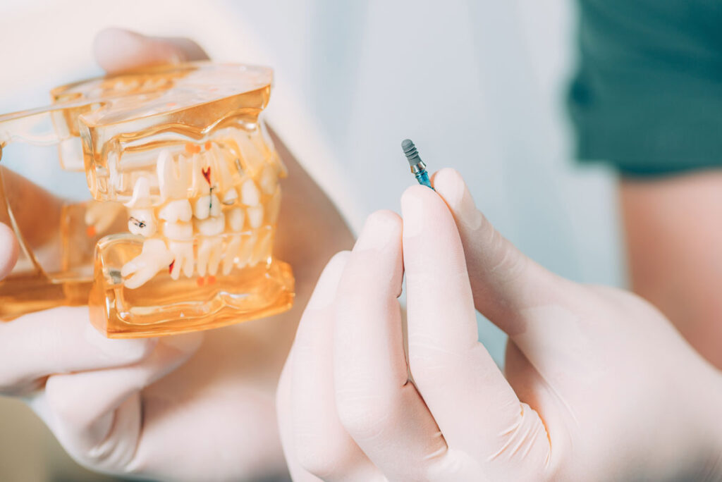 prim-plan cu un implant de dentar